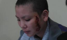 Cuộc đời u tối của cô gái bị xăm rết