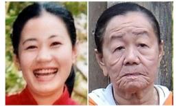 6 căn bệnh "siêu lạ" tại VN nổi tiếng thế giới