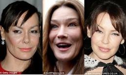 Những sao sở hữu gương mặt của... mèo!