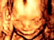 Lạ lùng em bé cười toe toét từ trong bụng mẹ