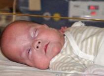 Em bé sinh non nhất thế giới