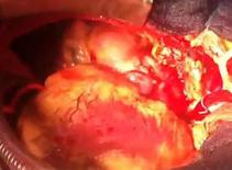 Người đàn ông có hai trái tim