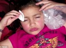 Mẹ tự bơm botox vào mặt con gái 8 tuổi để làm đẹp