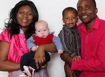 Thêm trường hợp cha mẹ da đen sinh con da trắng