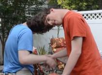 Tiết lộ ít biết về cặp song sinh dính liền đầu