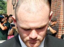 Chi 30.000 bảng cấy tóc, Rooney vẫn hói như xưa