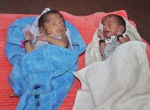 Bà mẹ Ấn Độ sinh hạ cặp sinh đôi từ hai tử cung riêng biệt 