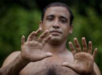 Kỳ lạ anh chàng có 24 ngón chân, tay đều đặn 