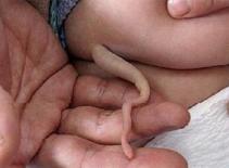 Kinh ngạc hình ảnh người mọc đuôi