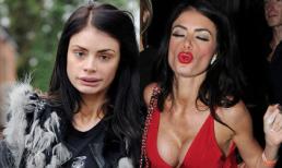 Chloe Sims lộ mặt mộc cứng đơ vì phẫu thuật thẩm mỹ