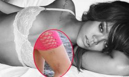 Đôi chân đầy sẹo của Rihanna "nuột nà" nhờ Photoshop