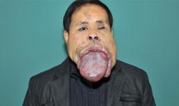 Người đàn ông có chiếc lưỡi khổng lồ