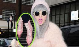 Ca sĩ người Anh gây chú ý với "giầy trượt đế dầy" kỳ quặc