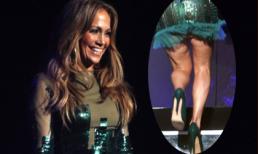 Những ngấn mỡ thừa 'khó đỡ' của Sao