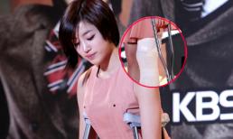 Eun Jung (T-ara) gặp tai nạn và chấn thương đầu gối