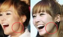 Những bức ảnh "lột tẩy" Jessica thẩm mỹ hàm? 