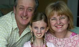 Thiếu nữ 25 tuổi già như bà lão 60