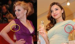 Sao phát ngượng vì "vùng nhạy cảm dưới cánh tay"