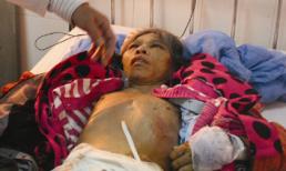 Đổ nước sôi vào chỗ kín, bắt osin dọn bỉm bằng miệng