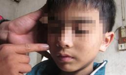 Vụ cha đẻ bắt con ăn phân: Mẹ kế thuật chuyện bạo hành