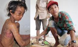 Vụ hành hạ trẻ em một thời chấn động công luận: Cuộc sống mới của Hào Anh