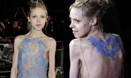 Người đẹp Anh Quốc khoe thân như "bộ xương di động"