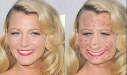 Kinh dị với mặt "chi chút mụn" của sao