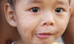 Cháu bé 20 tháng tuổi bị rạch mặt chằng chịt vì “tội” giống ông hàng xóm