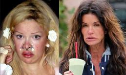 Chân dung siêu mẫu 'tàn tạ' vì phẫu thuật