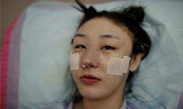 Những hình ảnh xem xong 'cạch' luôn phẫu thuật làm đẹp