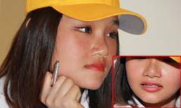 Miu Lê bị tróc da từng mảng