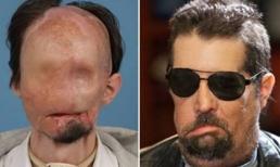 Những ca ghép mặt gây sửng sốt thế giới