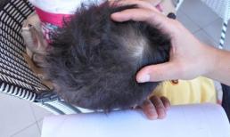 Giáo viên bị tố đánh 'chấn động não' bé 3 tuổi