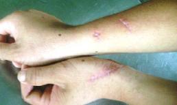 Khỉ 3 chân chuyên tấn công đàn ông ở Phú Yên