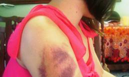 Tin lời cay độc của vợ kế nhẫn tâm đánh con ruột thừa sống thiếu chết