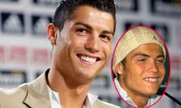 Điểm danh những ngôi sao từng 'phẫu thuật nụ cười'