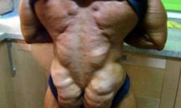 Những người có cấu tạo cơ thể dị thường