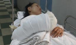 Bị chém lìa tay vẫn không để cướp chạy