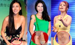 Những "vết tích" khó hiểu trên cơ thể sao