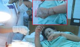 Cô gái đi xe SH bị chặt đứt tay giờ ra sao?