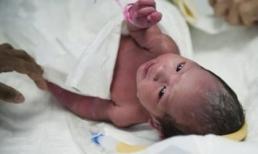 Những ca đẻ rơi kỳ lạ nhất Việt Nam