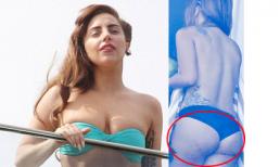 Lady Gaga lộ "bàn tọa" đầy mụn