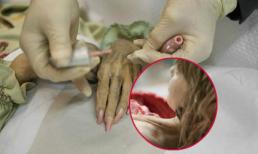 Rùng mình cận cảnh việc xử lý xác chết