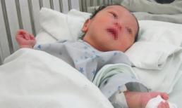 Phía sau hành động mẹ cắn đứt ngón tay con mới sinh