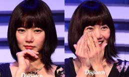 Mỹ nhân Hàn lộ da sần sùi với khóe mắt nhăn nheo