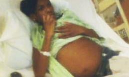 Bé gái 12 tuổi có "bụng bầu" nặng 8,6kg