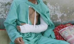 TP.HCM: Xông vào tận nhà chặt tay cướp điện thoại