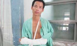 Nam thanh niên kể lại giây phút bị cướp chặt tay