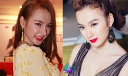 Sao Việt xuống sắc vì phẫu thuật thẩm mỹ