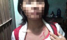 Vợ tố chồng điên cuồng bạo hành ở Hà Nội